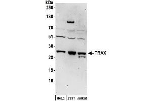Western Blotting (WB) image for anti-Translin-Associated Factor X (TSNAX) (AA 240-290) antibody (ABIN7453532)