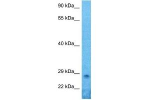 Host:  Rabbit  Target Name:  PRRX1  Sample Type:  Hela Whole Cell lysates  Antibody Dilution:  1. (PRRX1 Antikörper  (N-Term))