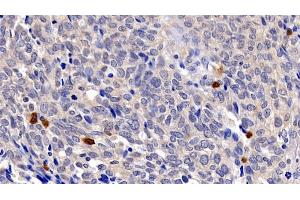 Immunohistochemistry (IHC) image for anti-Caspase 3 (CASP3) (AA 29-175) antibody (ABIN7428803)