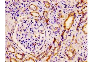 IHC image of ABIN7161406 diluted at 1:500 and staining in paraffin-embedded human kidney tissue performed on a Leica BondTM system. (PNPLA6 Antikörper  (AA 345-493))