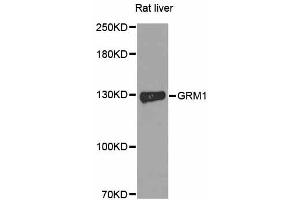 Western blot analysis of extracts of rat liver, using GRM1 antibody. (Metabotropic Glutamate Receptor 1 Antikörper)