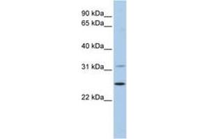 Image no. 1 for anti-Dehydrogenase/reductase (SDR Family) Member 1 (DHRS1) (AA 36-85) antibody (ABIN6743656) (DHRS1 Antikörper  (AA 36-85))