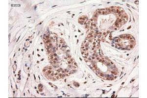 Image no. 2 for anti-Myc Proto-Oncogene protein (MYC) antibody (ABIN1497013) (c-MYC Antikörper)