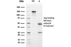Western Blotting (WB) image for anti-BCL2-Like 1 (BCL2L1) (AA 1-135) antibody (ABIN6940516)