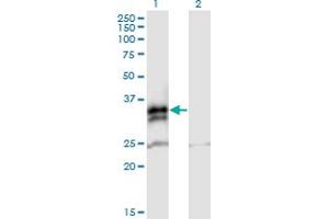 Western Blot analysis of FCN2 expression in transfected 293T cell line by FCN2 MaxPab polyclonal antibody. (Ficolin 2 Antikörper  (AA 1-313))