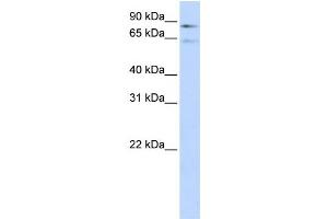 Western Blotting (WB) image for anti-Coagulation Factor 13, B Polypeptide (F13B) antibody (ABIN2458621) (F13B Antikörper)