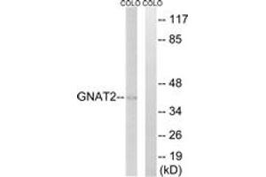 Western blot analysis of extracts from COLO cells, using GNAT2 Antibody. (GNAT2 Antikörper  (AA 1-50))