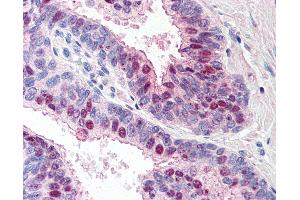 Anti-TARBP1 antibody IHC of human prostate. (TARBP1 Antikörper  (Internal Region))