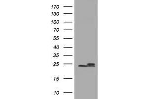 Image no. 9 for anti-NADH Dehydrogenase (Ubiquinone) 1 beta Subcomplex, 10, 22kDa (NDUFB10) antibody (ABIN1499672) (NDUFB10 Antikörper)