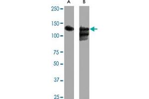 Western blot analysis of SIRT1 polyclonal antibody  expression in Hela (A) and Hela + CoC 12  (B) whole cell lysates. (SIRT1 Antikörper  (C-Term))