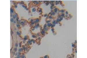Immunohistochemistry (Paraffin-embedded Sections) (IHC (p)) image for anti-CD90 (THY1) (AA 20-131) antibody (ABIN2902611)