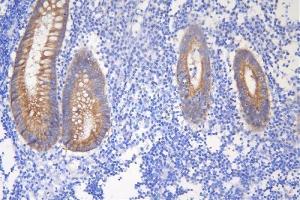 IHC analysis of DSG2 using anti-DSG2 antibody (ABIN7600803).