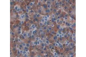 IHC-P analysis of Human Tissue, with DAB staining. (CXCL2 Antikörper  (AA 34-107))
