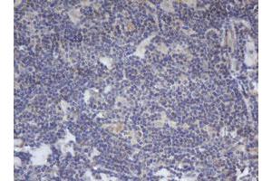 Image no. 1 for anti-B-Cell CLL/lymphoma 10 (BCL10) antibody (ABIN1496847) (BCL10 Antikörper)