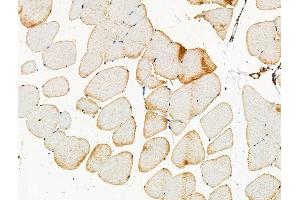 Phospho-PKD1/PKC mu (Ser205) Antibody at 1/100 staining Mouse muscle tissue by IHC-P. (PKC mu Antikörper  (pSer205))