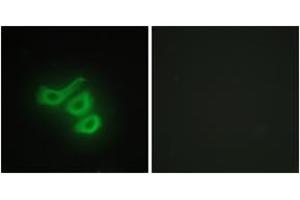 Immunofluorescence analysis of HepG2 cells, using M-CK Antibody. (CKM Antikörper  (AA 10-59))