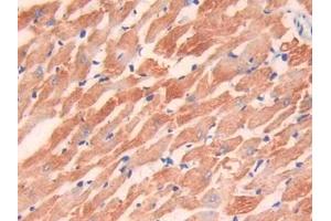 IHC-P analysis of Rat Heart Tissue, with DAB staining. (TNNI3 Antikörper  (AA 1-211))