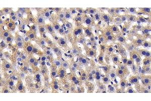 Immunohistochemistry (IHC) image for anti-ATG7 Autophagy Related 7 (ATG7) (AA 477-698) antibody (ABIN7441640)