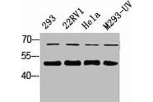 Western Blot analysis of 823 22RV1 HELA 293-UV cells using Smad2/3 Polyclonal Antibody (SMAD2 / SMAD3 Antikörper)