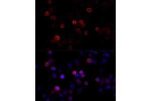 Immunofluorescence analysis of HeLa cells using FLNC antibody (ABIN6127928, ABIN6140681, ABIN6140682 and ABIN6216847) at dilution of 1:100 (40x lens). (FLNC Antikörper  (AA 2160-2340))