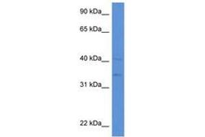 Image no. 1 for anti-Lipase A, Lysosomal Acid, Cholesterol Esterase (LIPA) (AA 42-91) antibody (ABIN6746942) (Lipase A Antikörper  (AA 42-91))