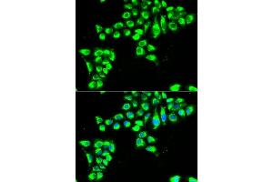 Immunofluorescence analysis of HeLa cells using CLDN2 antibody (ABIN6127703, ABIN6138684, ABIN6138687 and ABIN6222231). (Claudin 2 Antikörper  (AA 30-230))