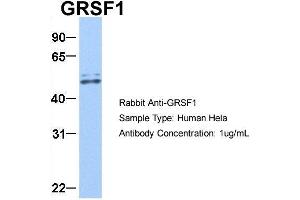 Host:  Rabbit  Target Name:  GRSF1  Sample Type:  Hela  Antibody Dilution:  1. (GRSF1 Antikörper  (Middle Region))