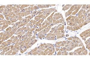 Detection of ACTC1 in Human Cardiac Muscle Tissue using Monoclonal Antibody to Actin Alpha 1, Cardiac Muscle (ACTC1) (ACTC1 Antikörper  (AA 156-368))