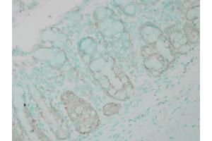 Immunohistochemistry (IHC) image for anti-Ubiquitin (Ub) antibody (HRP) (ABIN2481457)