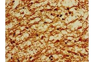 Immunohistochemistry of paraffin-embedded human brain tissue using ABIN7164051 at dilution of 1:100