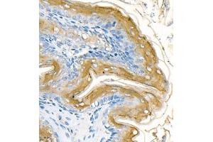 Immunohistochemistry of paraffin embedded rat stomach using CK13 (ABIN7074411) at dilution of 1:1200 (400x lens) (Cytokeratin 13 Antikörper  (C-Term))