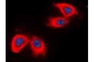 Immunofluorescent analysis of DCLK2 staining in HepG2 cells. (DCLK2 Antikörper  (N-Term))