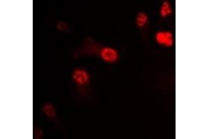 Immunofluorescent analysis of P2X4 staining in U2OS cells. (P2RX4 Antikörper)