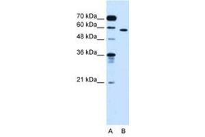 Image no. 2 for anti-Oxysterol Binding Protein-Like 9 (OSBPL9) (AA 73-122) antibody (ABIN6736683) (OSBPL9 Antikörper  (AA 73-122))