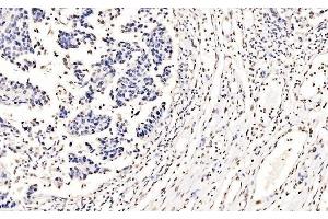 IHC analysis of splicing factor 1 using anti-splicing factor 1 antibody (ABIN7600193).
