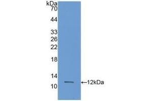 Detection of Recombinant S100A11, Rat using Polyclonal Antibody to S100 Calcium Binding Protein A11 (S100A11) (S100A11 Antikörper  (AA 9-98))