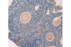 IHC-P analysis of ovary tissue, with DAB staining. (GDF5 Antikörper  (AA 358-495))
