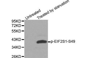 Western blot analysis of extracts from Hela cells, using phospho-EIF2S1-S49 antibody. (EIF2S1 Antikörper  (pSer49))