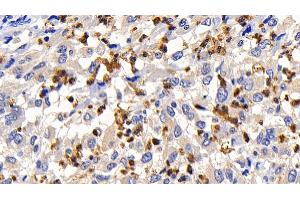 Immunohistochemistry (IHC) image for anti-BCL2-Like 1 (BCL2L1) (AA 2-212) antibody (ABIN7426781)