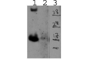 Lane 1 - mIL15 transfectant; Lane 2 - Control; Lane 3 - Marker (IL-15 Antikörper)