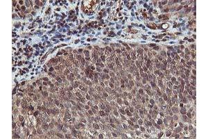 Image no. 9 for anti-V-Akt Murine Thymoma Viral Oncogene Homolog 1 (AKT1) antibody (ABIN1496557) (AKT1 Antikörper)