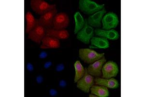 ABIN7094233 and ABIN7098280 staining Hela cells by IF/ICC. (FHL2 Antikörper  (Internal Region))