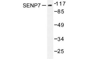 Image no. 1 for anti-SUMO1/sentrin Specific Protease 7 (SENP7) antibody (ABIN271960) (SENP7 Antikörper)