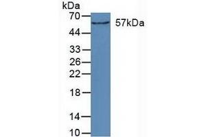 Detection of CYP27B1 in Mouse Kidney Tissue using Polyclonal Antibody to Cytochrome P450 27B1 (CYP27B1) (CYP27B1 Antikörper  (AA 256-508))