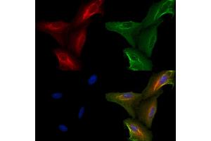 ABIN6264768 and ABIN6272617 staining  cells by IF/ICC. (RIPK3 Antikörper  (Internal Region))