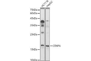 Western blot analysis of extracts of various cell lines, using CENPA antibody (ABIN7266271) at 1:1000 dilution. (CENPA Antikörper  (AA 1-100))