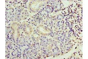 Immunohistochemistry of paraffin-embedded human pancreatic tissue using ABIN7169410 at dilution of 1:100 (SMYD4 Antikörper  (AA 1-260))