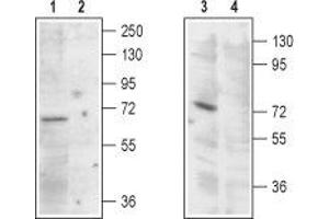 Mucolipin 1 (MCOLN1) peptide