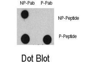Image no. 1 for anti-Epidermal Growth Factor Receptor (EGFR) (pTyr1125) antibody (ABIN358328) (EGFR Antikörper  (pTyr1125))