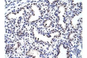 WNT2B antibody was used for immunohistochemistry at a concentration of 4-8 ug/ml to stain Alveolar cells (arrows) in Human Lung.